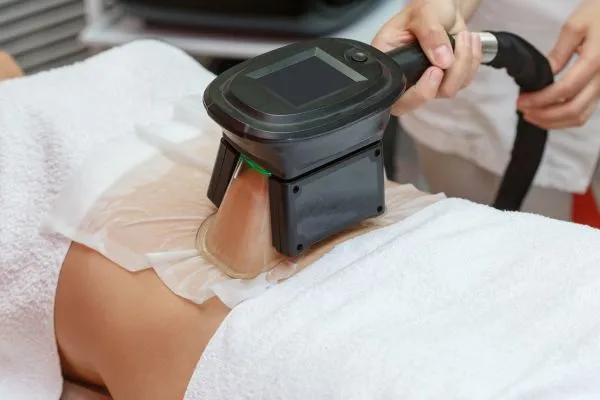 Image of person having fat freezing treatment to help weight gain Small Heath
