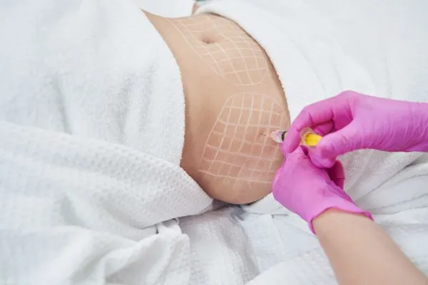 image of fat dissolving injections on love handles to help combat weight gain Small Heath